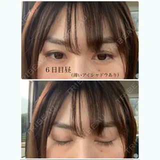5日目の経過画像（1枚目）