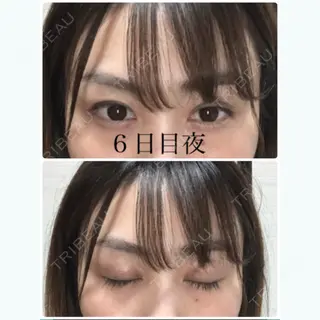 5日目の経過画像（1枚目）