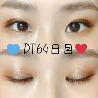 65日目の経過画像（1枚目）