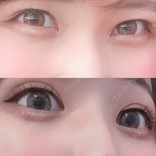 96日目の経過画像（1枚目）