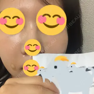 3日目の経過画像（1枚目）