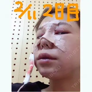 1日目の経過画像（1枚目）