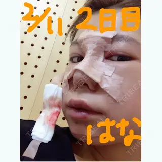 1日目の経過画像（2枚目）