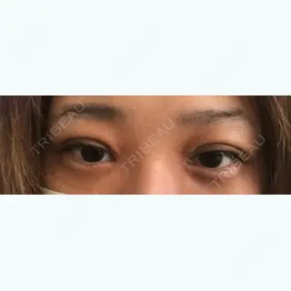 9日目の経過画像（1枚目）