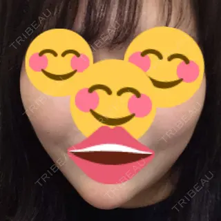 5日目の経過画像（1枚目）