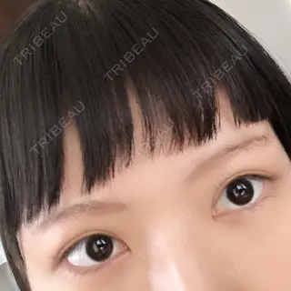 22日目の経過画像（1枚目）