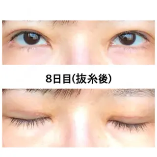 8日目の経過画像（1枚目）