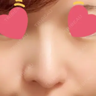 120日目の経過画像（1枚目）