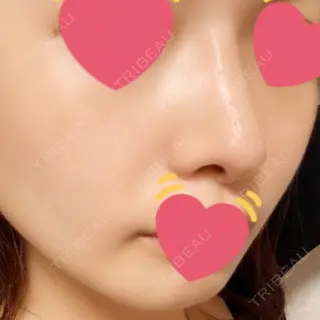 120日目の経過画像（3枚目）