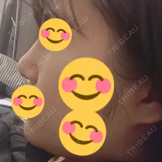 5日目の経過画像（3枚目）