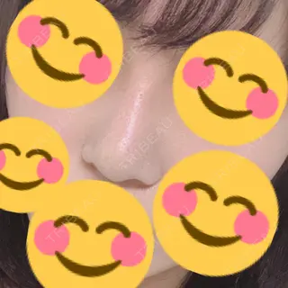 15日目の経過画像（1枚目）