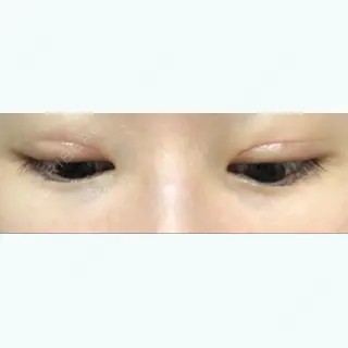 9日目の経過画像（2枚目）