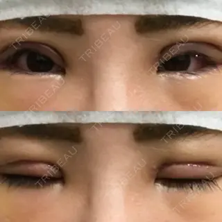7日目の経過画像（1枚目）