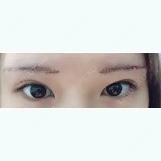 16日目の経過画像（1枚目）