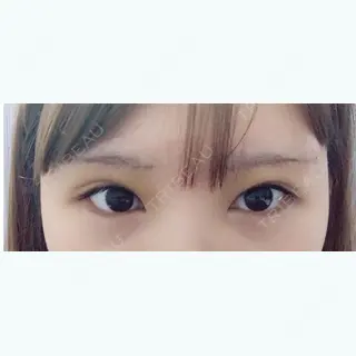 18日目の経過画像（1枚目）