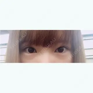21日目の経過画像（1枚目）