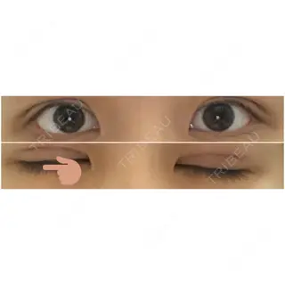 1日目の経過画像（1枚目）