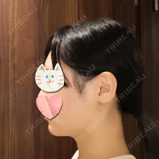 19日目の経過画像（3枚目）