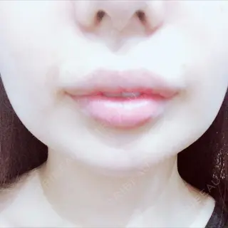 3日目の経過画像（2枚目）