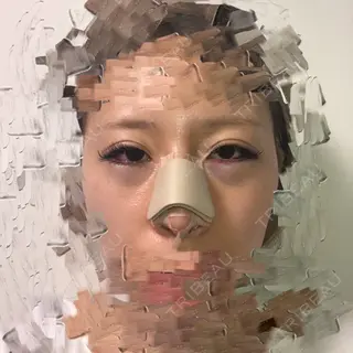 0日目の経過画像（1枚目）
