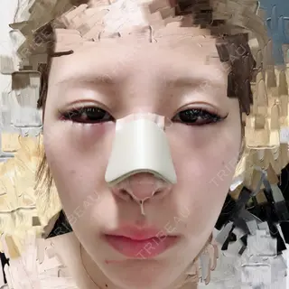 1日目の経過画像（1枚目）