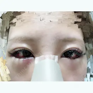 1日目の経過画像（2枚目）