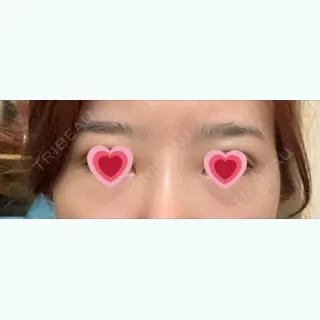 61日目の経過画像（1枚目）