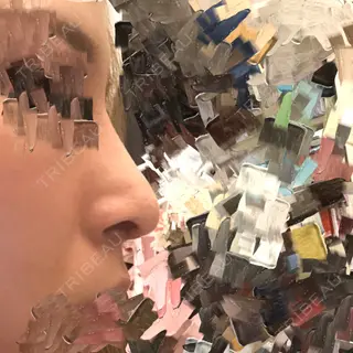 10日目の経過画像（2枚目）