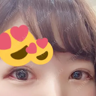 25日目の経過画像（1枚目）