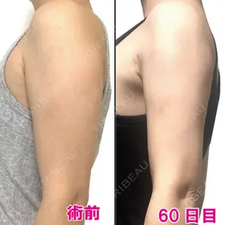 60日目の経過画像（2枚目）