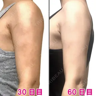 60日目の経過画像（3枚目）