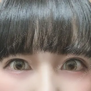 23日目の経過画像（1枚目）