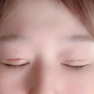 10日目の経過画像（3枚目）