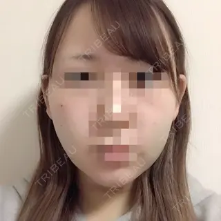 2日目の経過画像（2枚目）