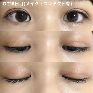 18日目の経過画像（1枚目）