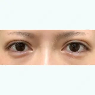 7日目の経過画像（1枚目）