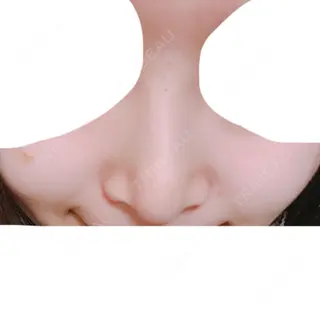 117日目の経過画像（3枚目）