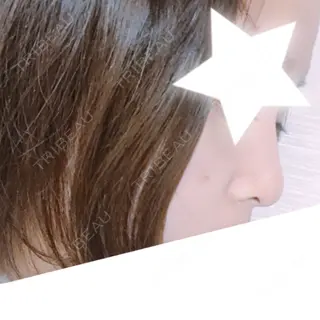 117日目の経過画像（2枚目）