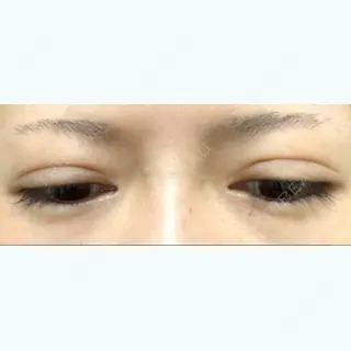 8日目の経過画像（2枚目）