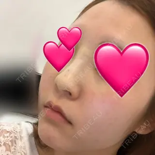 0日目の経過画像（3枚目）