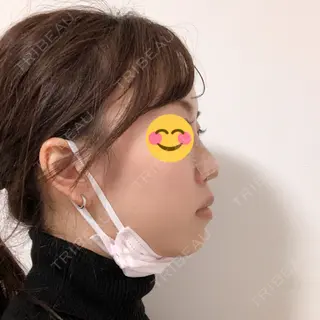 1日目の経過画像（2枚目）