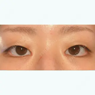 9日目の経過画像（2枚目）