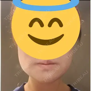 3日目の経過画像（1枚目）