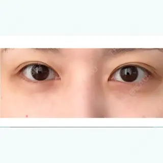 65日目の経過画像（1枚目）