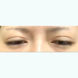 10日目の経過画像（3枚目）