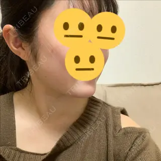 1日目の経過画像（2枚目）