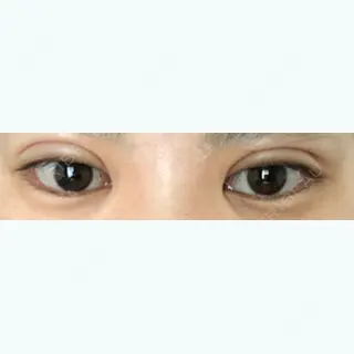 2日目の経過画像（1枚目）