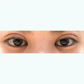 2日目の経過画像（2枚目）