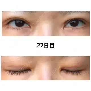 22日目の経過画像（1枚目）