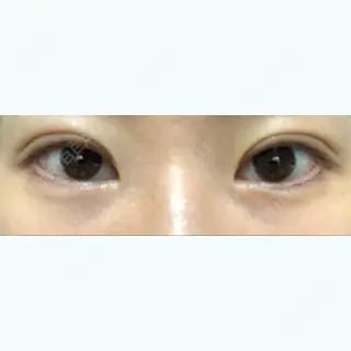 19日目の経過画像（1枚目）